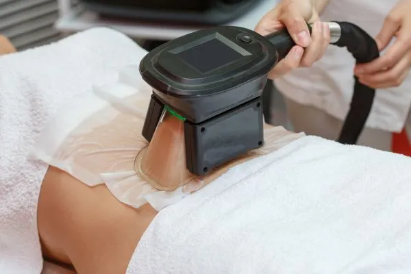 Image of person having fat freezing treatment to help weight gain Yeovil