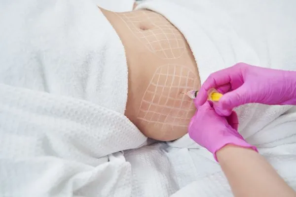 image of fat dissolving injections on love handles to help combat weight gain Yeovil