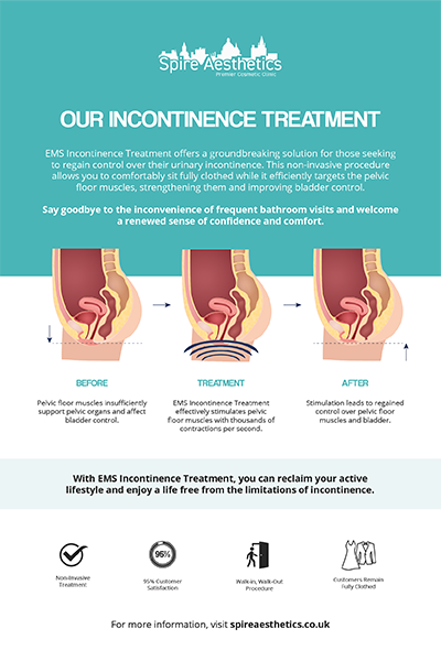 image to show how EMS treatment works for female urinary incontinence Yeovil