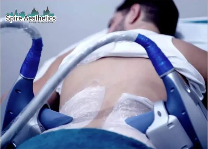 Man having fat freezing treatment done on love handles before a competitions Yeovil to create a sculpted look.