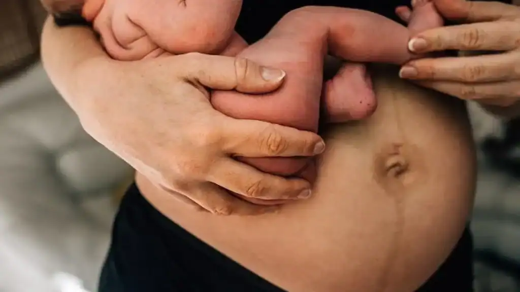 Why Is My Stomach Still Big After Pregnancy Yeovil?